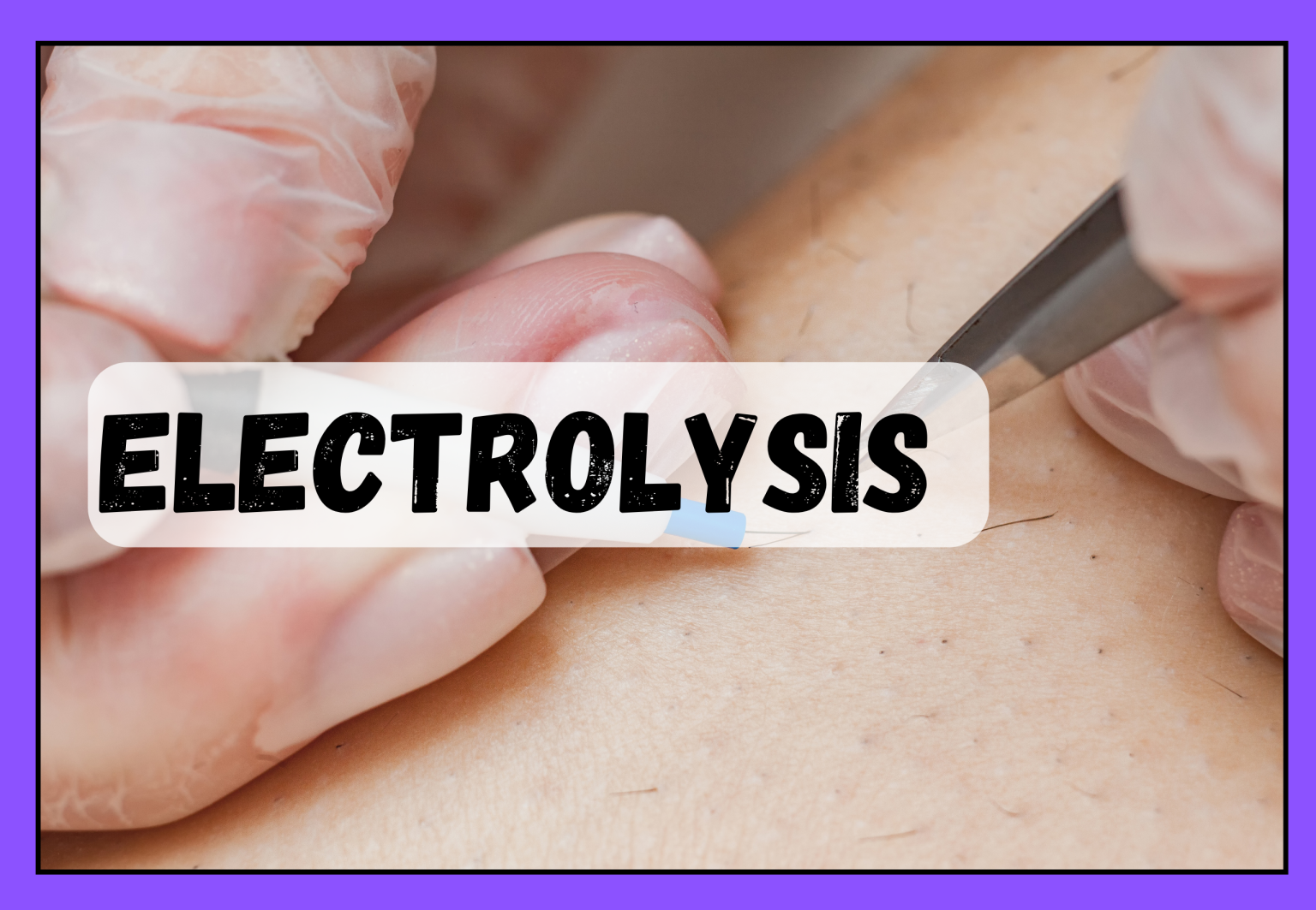 Laser Hair and Removal Center Greenville, NC